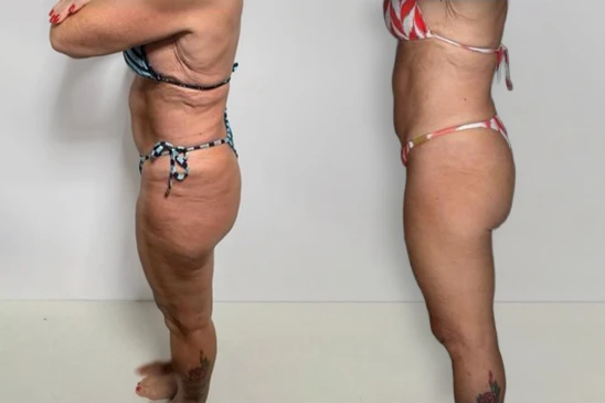 antes-e-depois-2