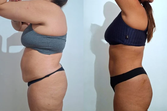 antes-e-depois-3
