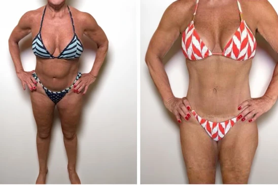 antes-e-depois-4