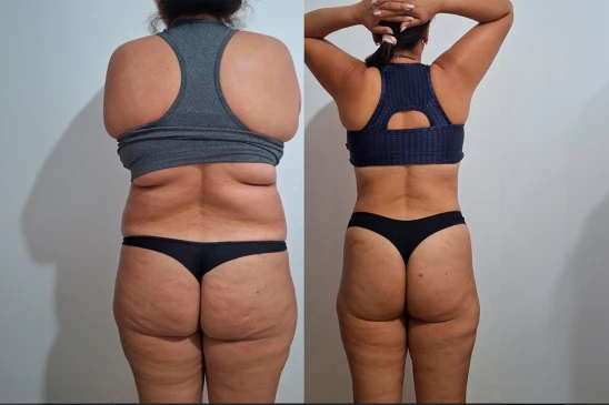 antes-e-depois-5