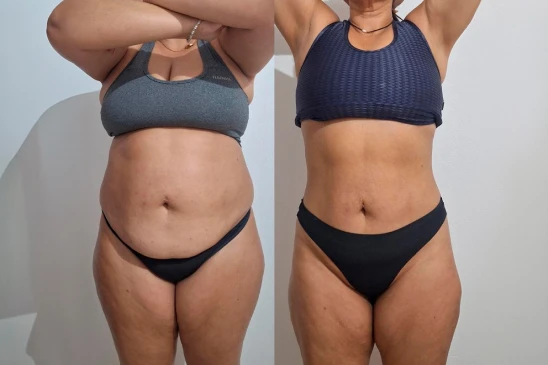 antes-e-depois-6