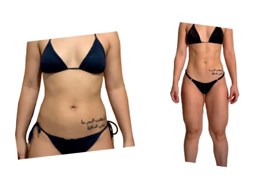 antes-e-depois-7