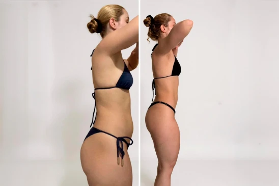 antes-e-depois-9